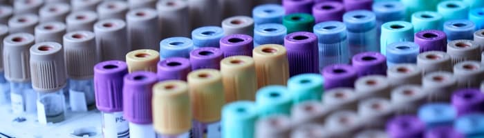 Во время пандемии ухудшились результаты анализов жителей: какие медицинские проверки рекомендуется проводить в лаборатории и в домашних условиях?