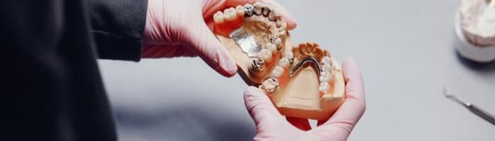 Kā kopt zobu protēzes, lai dzīvotu bez raizēm