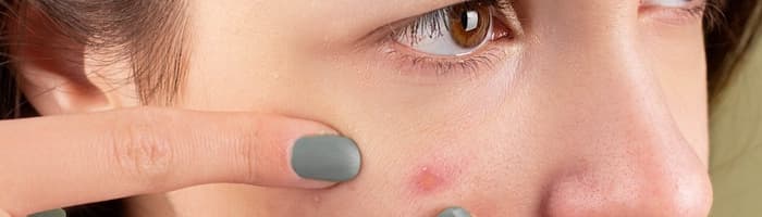 Азбука ухода за лицом для подростков – с чего начинать и на что обратить внимание весной