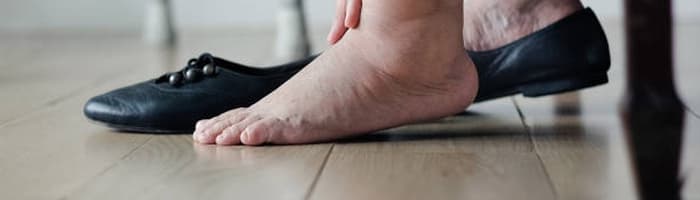 Одна из самых актуальных летних проблем – отеки ног. Что делать?