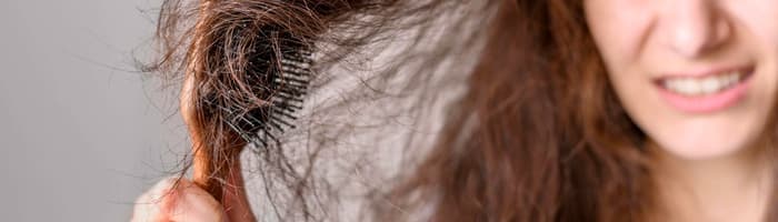 Спутавшиеся, ломкие, тусклые – советы по уходу за волосами зимой