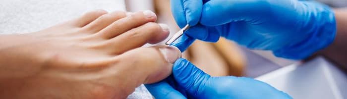 Пусть грибы растут в лесу, а не на ногтях! 5 советов по предотвращению грибка