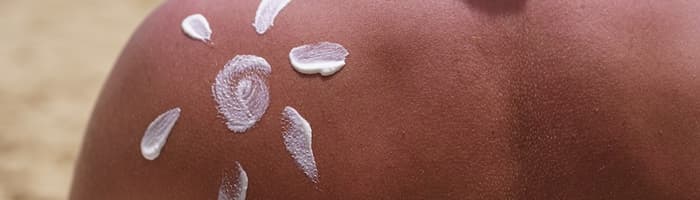 Krējums, etiķis un karsta duša: mīti par saules apdegumu ārstēšanu