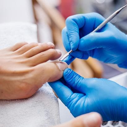 Lai sēnes aug mežā, nevis uz nagiem! 5 padomi, kā novērst sēnītes veidošanos